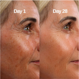 Restore+ Collagen Melting Mask Complete Set